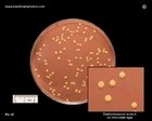 Staphylococcus aureus on chocolate agar